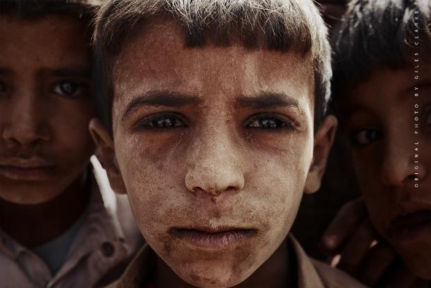 A fotografia mostra três crianças afetadas pela guerra do Iémen. A imagem fez parte da campanha da ONU #NotATarget. Foto: Giles Clarke